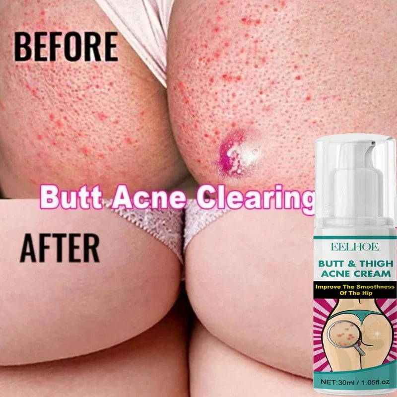 Women Body Lightening Cream Brighten Dull Fade Pimples Moisturize Lotion Butt Inner Thigh Brightening Serum Buttock Smooth Cream