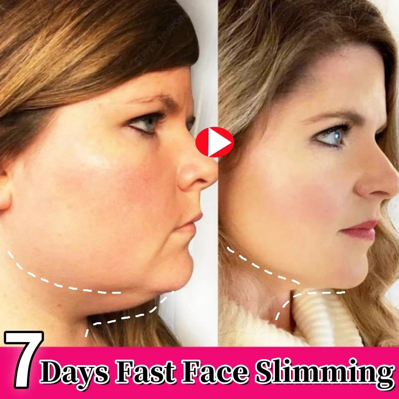 V-Shape Face Slimming Cream Remove Double Chin Firm Lift To Create A Small V Face Fat Burning Anti-aging Shaping Massage Product