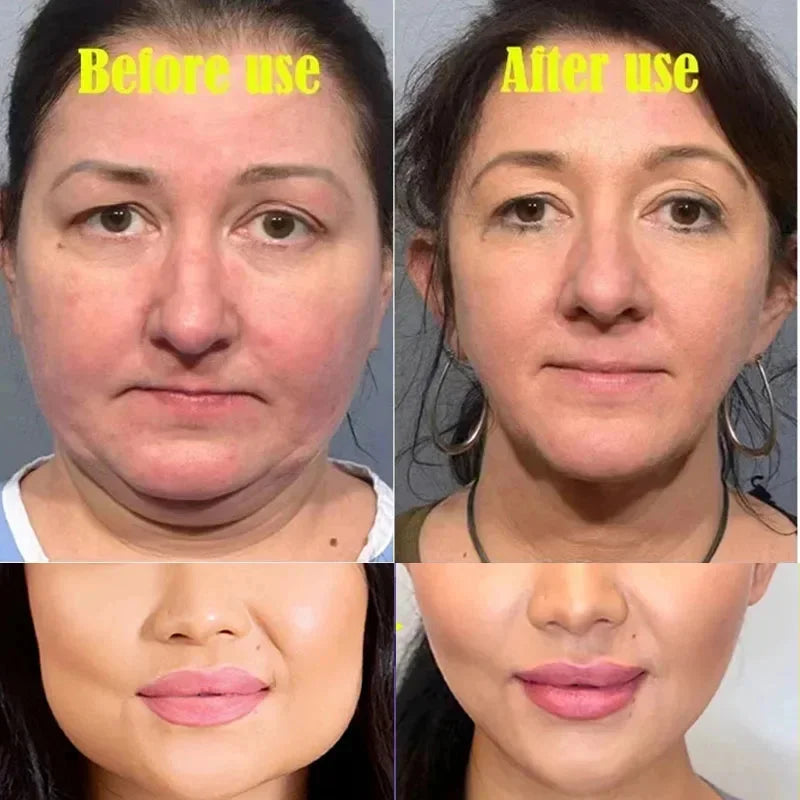 V-Shape Face Slimming Cream Remove Double Chin Firm Lift To Create A Small V Face Fat Burning Anti-aging Shaping Massage Product