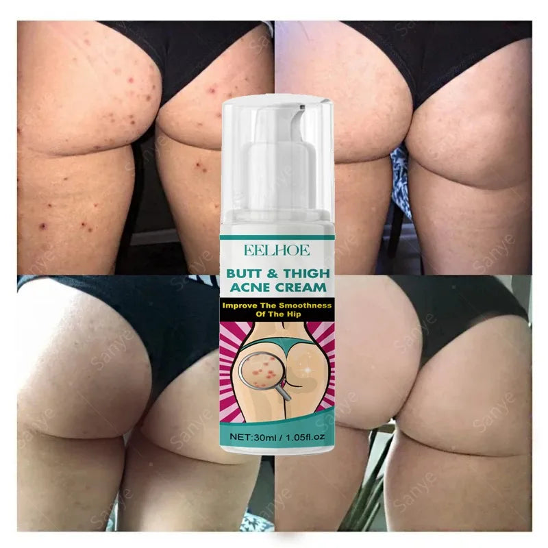 Women Body Lightening Cream Brighten Dull Fade Pimples Moisturize Lotion Butt Inner Thigh Brightening Serum Buttock Smooth Cream