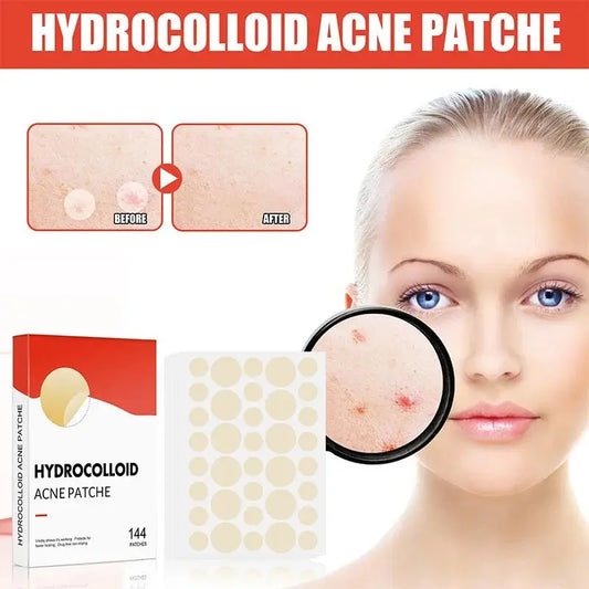 144pcs/set Face Skin Care Acne Pimple Patch 2 Sizes Invisible Professional Healing Absorbing Spot Sticker Covering for Men Women