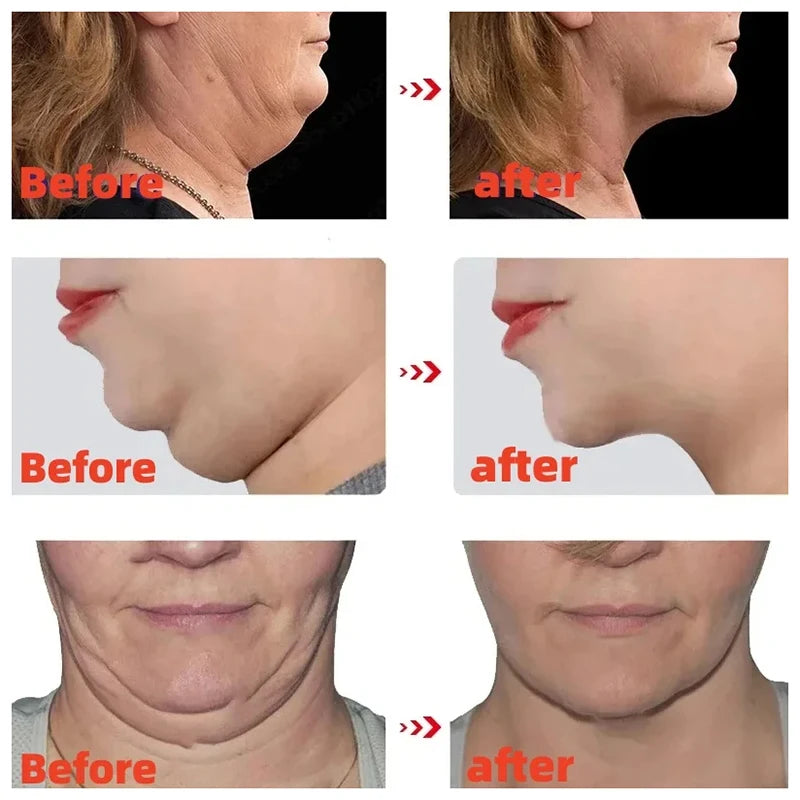 V Face Slimming Cream Enzyme Massage Cream Firm Face Lift To Remove Masseter Double Chin To Lighten Neck Line Fat Burning Cream